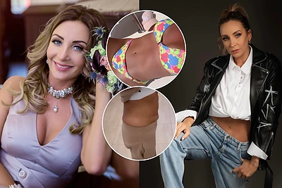 G.Žemaitė ryžosi plastinei operacijai ir parodė rezultatus: prieš tai sulaukė įžeidžių komentarų