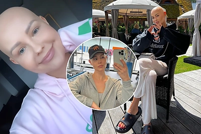 I.Burlinskaitė – apie sveikimo požymius ir pasikeitusius įpročius: „Nedarykite, kaip dariau aš“