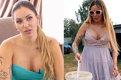 Justina Partikė atskleidė, kodėl ryžosi susimažinti krūtinę: „Oda vos nulaikė implantus“