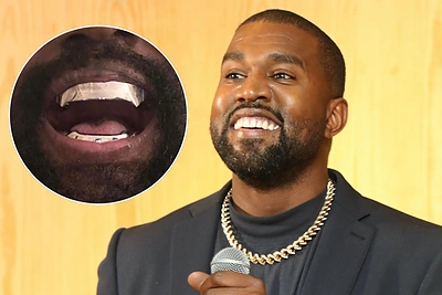 Šokiruojantis Kanye Westo poelgis – atsisakė tikrų dantų: paaiškėjo, kuo juos pakeitė