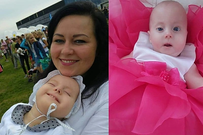 Mirė Edvardso sindromą turėjusi mažoji Elzė: „Mūsų visų širdžių karalienė mus paliko“