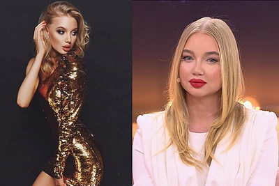 Karolina Toleikytė prabilo apie patyčias: „Mane mušė ir sakė, kad sutrins modelio veidą į asfaltą“