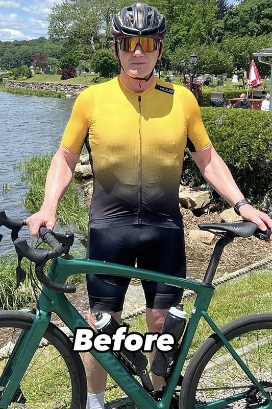 Gordonas Ramsay po dviračio avarijos / Socialinių tinklų nuotr.