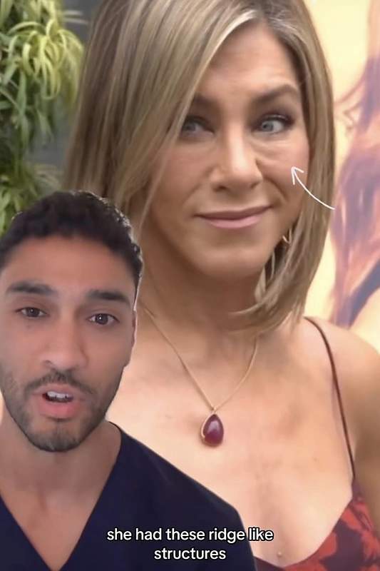 Galimi Jennifer Aniston išvaizdos pokyčiai / Stop kadras