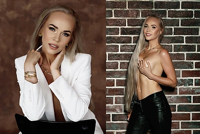 Plyšus krūties implantui Ieva Voveris kategoriškai apsisprendė: „Vyras prieštaravo, bet kūnas – mano“