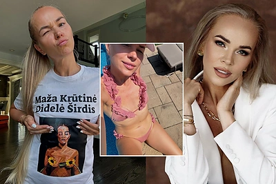 Ievai Voveris po krūtų mažinimo operacijos – nemaloni vyro replika: palygino su buvusiomis