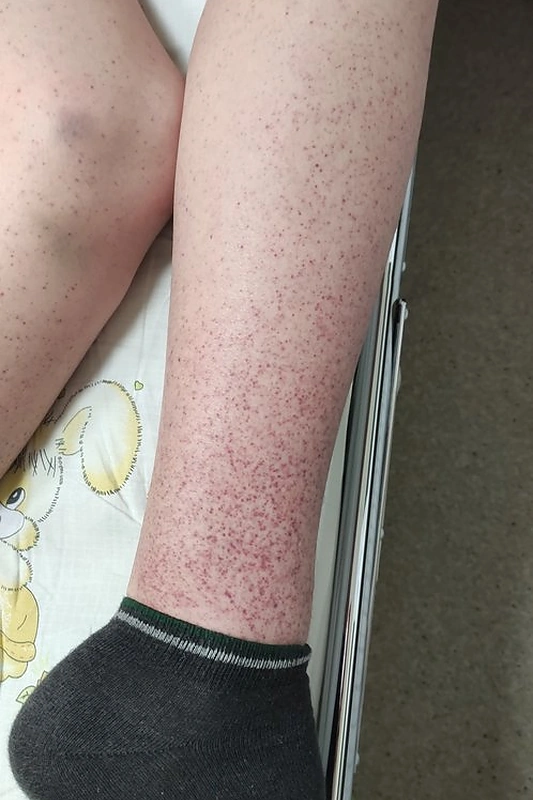 „Mamų unijos“ globotinis 12-metis Dovydas / Asmeninio albumo nuotr.