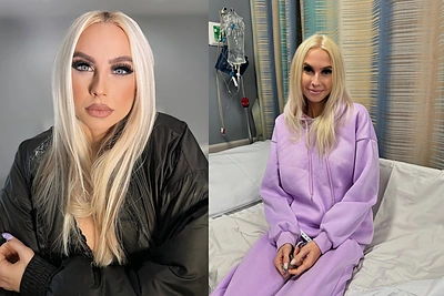 Simonai Milinytei – vėžys: laukia itin sudėtinga operacija