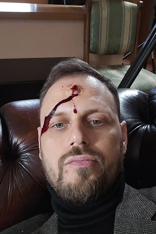 Arnoldas Eisimantas seriale „Rimti reikalai“ / Asmeninio albumo nuotr.