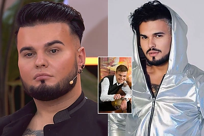 Vytenis Partikas paviešino, kaip atrodė prieš grožio procedūras: „Ir toliau krapštykite nosį iš pavydo“