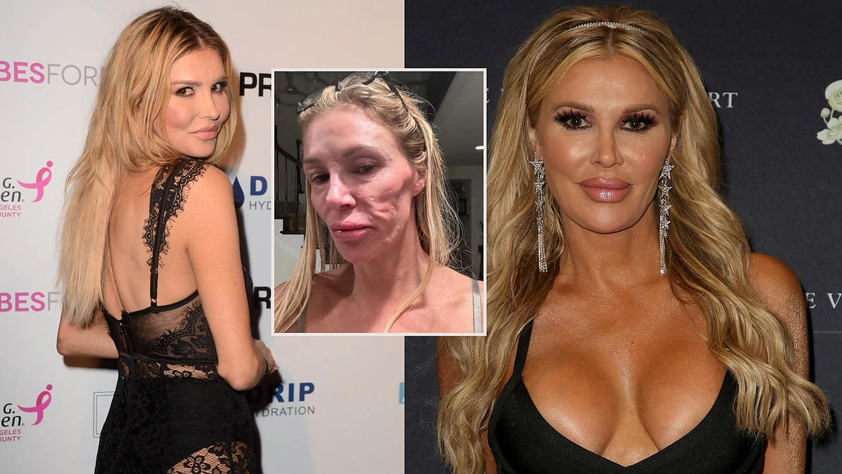 Brandi Glanville / Scanpix ir socialinių tinklų nuotr.
