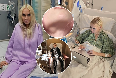 Po atliktos vėžio šalinimo operacijos S.Milinytei – neraminantys tyrimų rezultatai: „Atsiranda vis daugiau darinių“