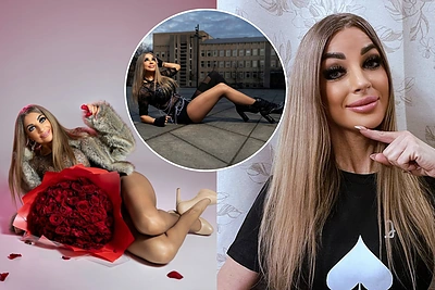 45-erių kaunietė Jelena kausto žvilgsnius: apie lemtingą diagnozę ir aukštakulnius-„gelbėtojus“