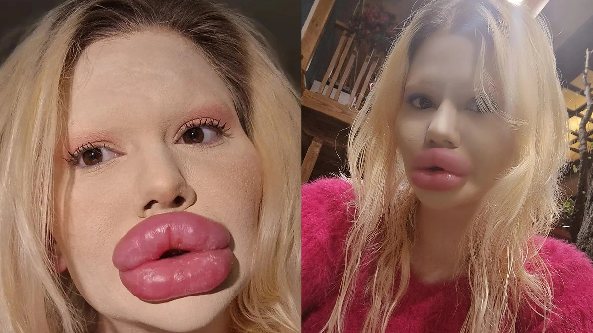 Andrea Ivanova / Soc. tinklų nuotr.