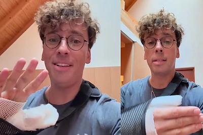 Jūrmaloje Maksimą Galkiną partrenkė automobilis: paaiškėjo, ar komikas pasirodys Palangoje