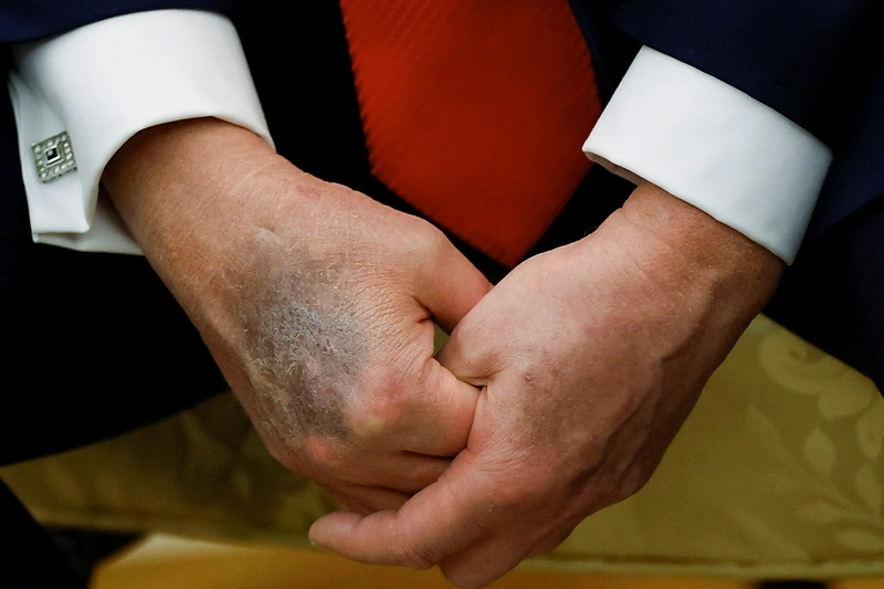 Donaldo Trumpo ranka / Scanpix nuotr.