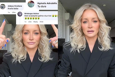 Ugnė Siparė rėžė purvą ant jos pilantiems žmonėms – pareiškimas nustebino ne vieną