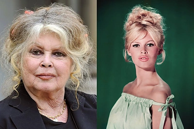Prancūzų kino legenda Brigitte Bardot atsidūrė ligoninėje