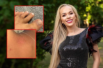 Ieva Voveris atvirai parodė tai, ką ilgą laiką slėpė – prakalbo apie lemtingą dieną: „Taip reikalavo pasaulis...“