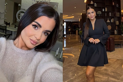Simona Lipnė pirmą kartą prabilo apie pasikeitusią išvaizdą ir gandus, kad lieknėja dėl „Ozempic“