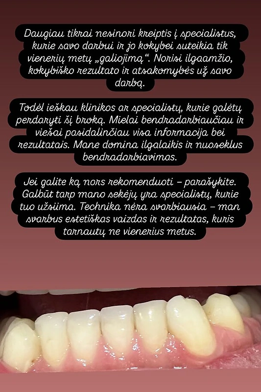 Vytenio Partiko istorija / „Instagram“ nuotr.