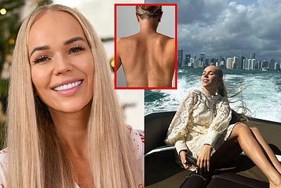 Ieva Voveris parodė kitą prabangaus gyvenimo Dubajuje pusę: „padovanojo“ odos ligą