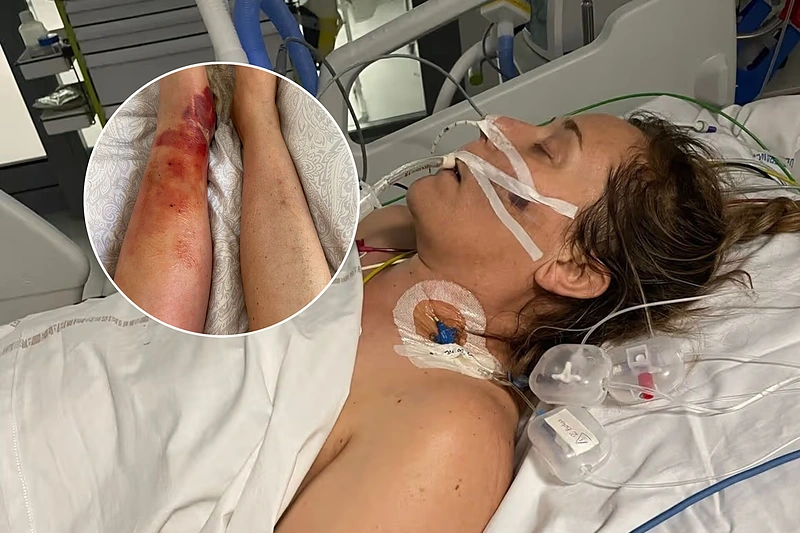 Moteris / „The Mirror“ portalo nuotr. / „15min“ fotomontažas