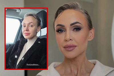 Rima Petrauskytė vos suvaldė emocijas – pranešė apie laukiančias 2 operacijas: „Sukryžiavusi pirštus laikau“