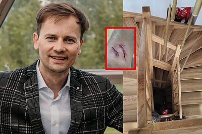 Nerijus Juška patyrė rimtą incidentą namuose – vos nesibaigė didele nelaime: „Gyvenimas prabėgo per kelias sekundes“