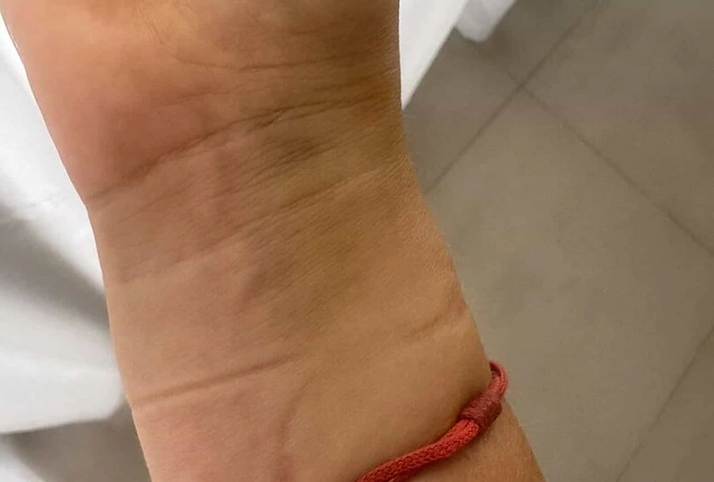 Ieva Voveris patyrė riešo traumą / Asmeninio archyvo nuotr.