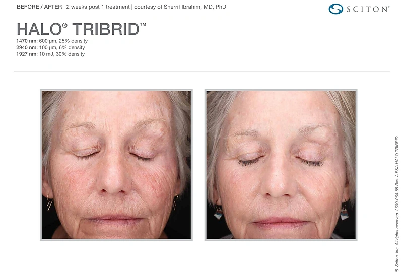 Pirmasis planetoje trigubas veido atjauninimas / „Sapiegos klinikos“ nuotr.