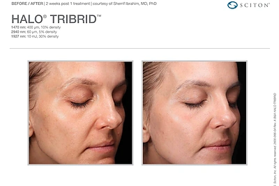 Pirmasis planetoje trigubas veido atjauninimas / „Sapiegos klinikos“ nuotr.