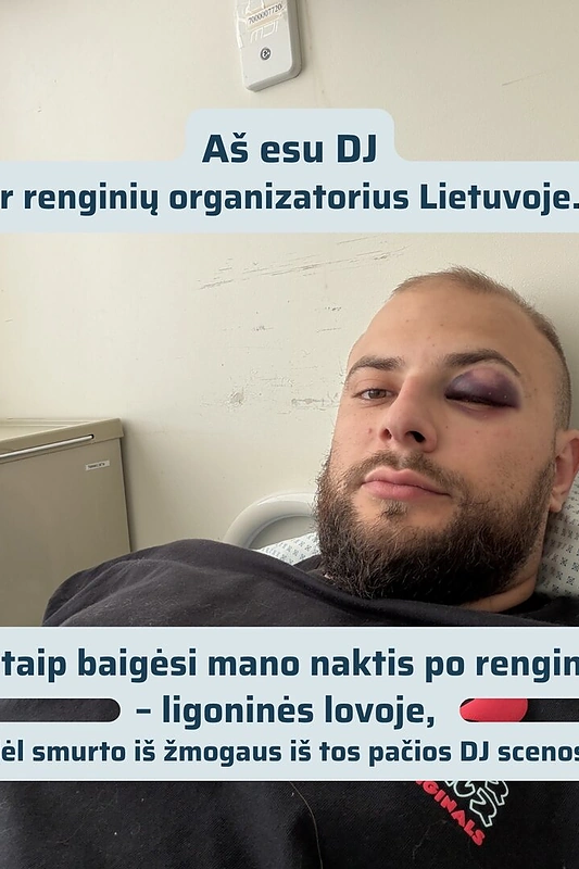 Vladas Starque / Soc. tinklų nuotr.