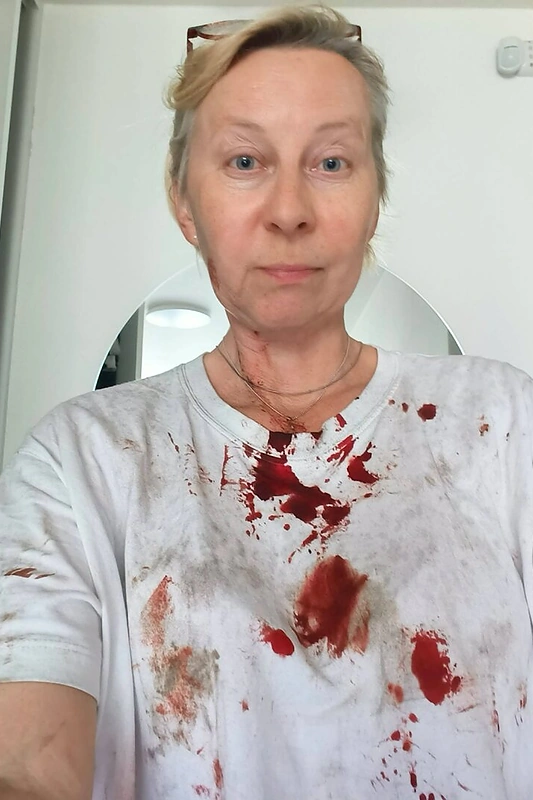 Jurga Varanavičius prabilo apie išpuolį / „Facebook“ nuotr.