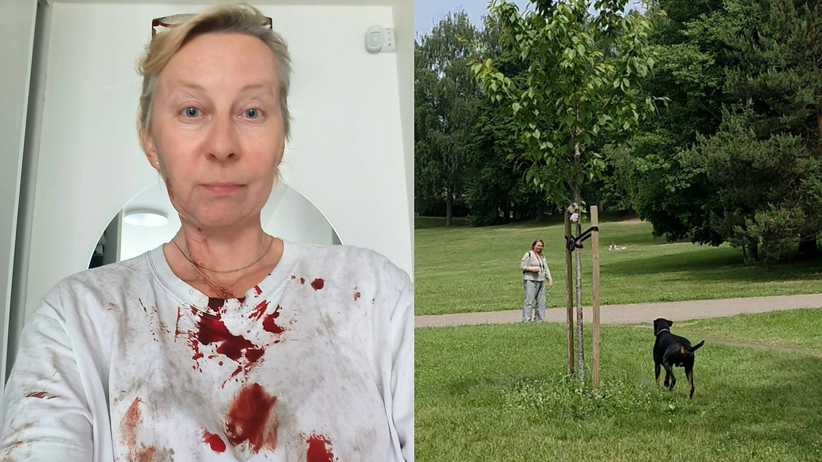 Jurga Varanavičius prabilo apie išpuolį / „Facebook“ nuotr.