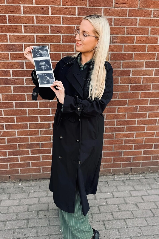 Guoda Dobilaitė-Eitutė netrukus taps mama / Asmeninio albumo nuotr.
