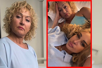 Plyšus krūtų implantui – Oksanos Pikul mama atsidūrė ant operacinės stalo