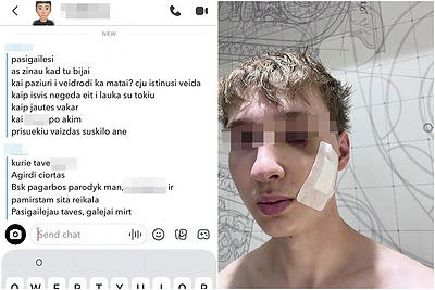 Paauglių gauja Klaipėdoje žiauriai sumušė jaunuolį: „Suskilo vaizdas, ar ne?“